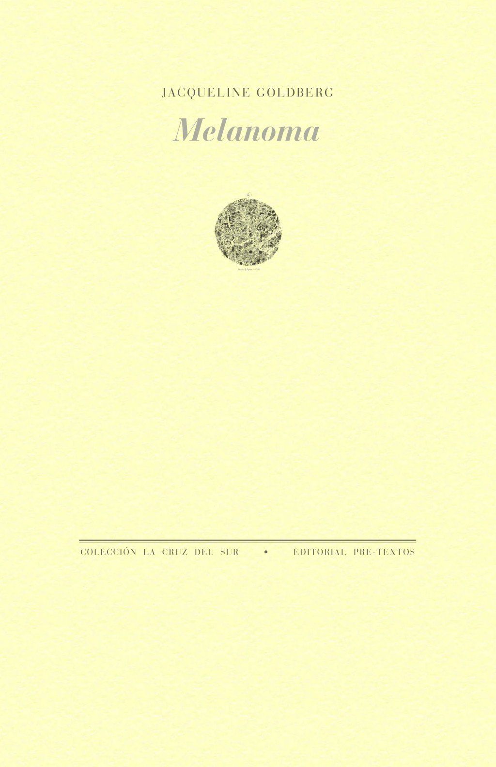 Melanoma